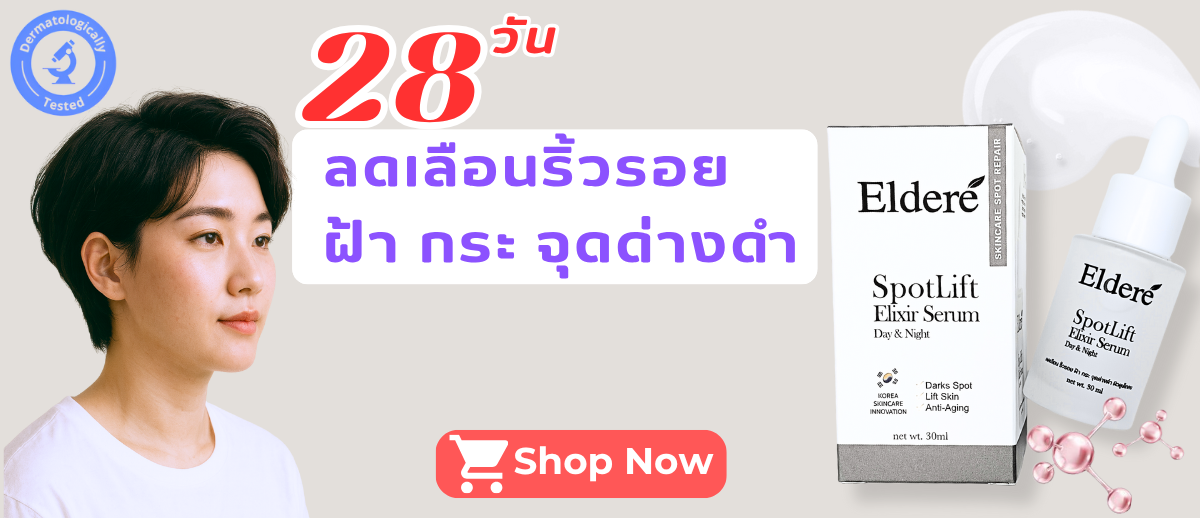 ปัจจัยที่ทำให้เกิดสิว