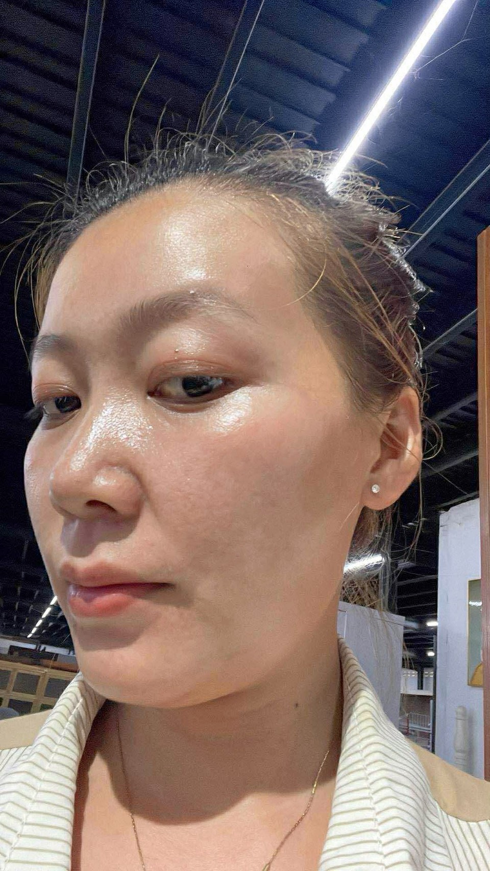 หลังใช้เซ็ต Elderé