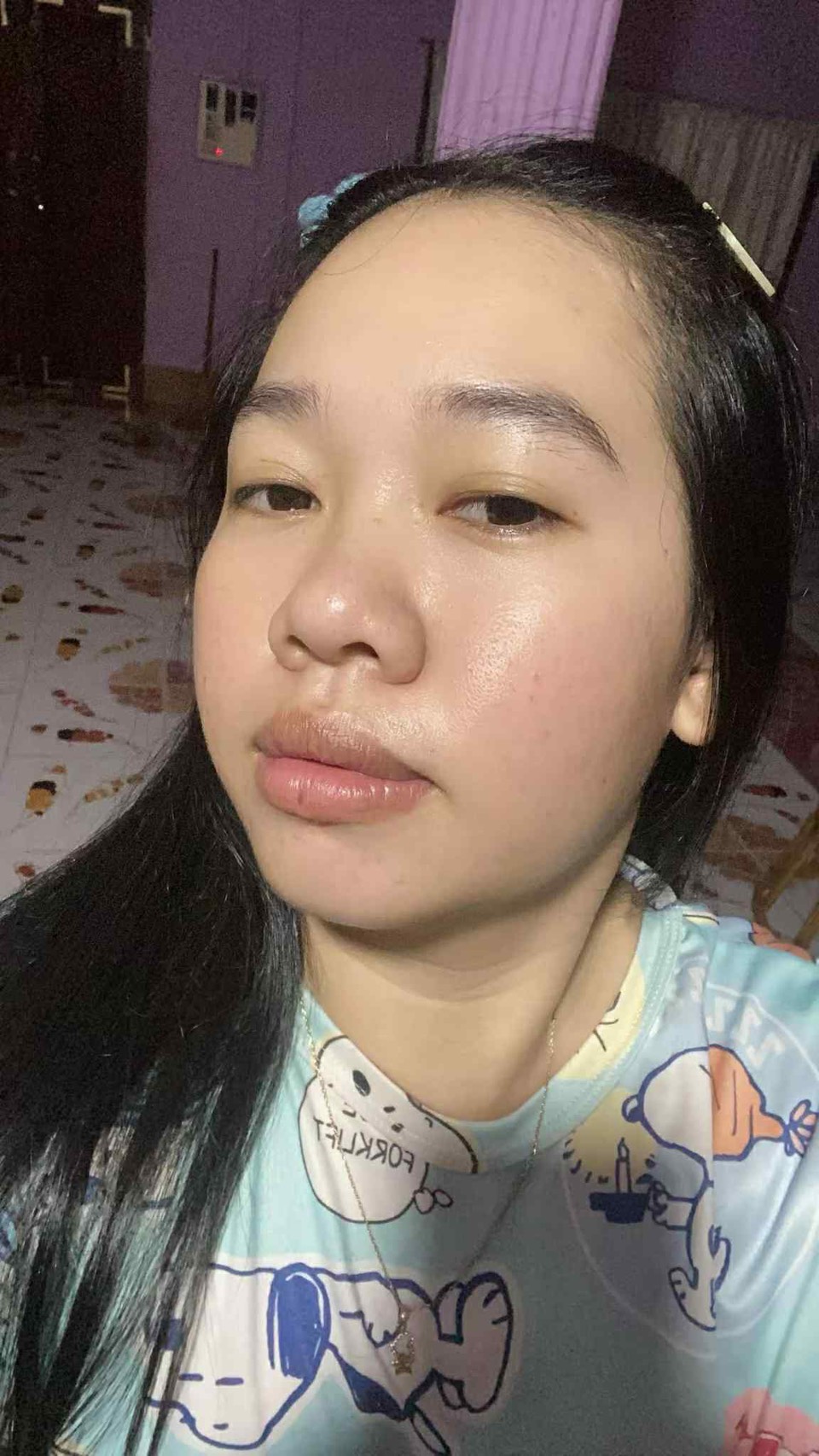 หลังใช้เซ็ต Elderé