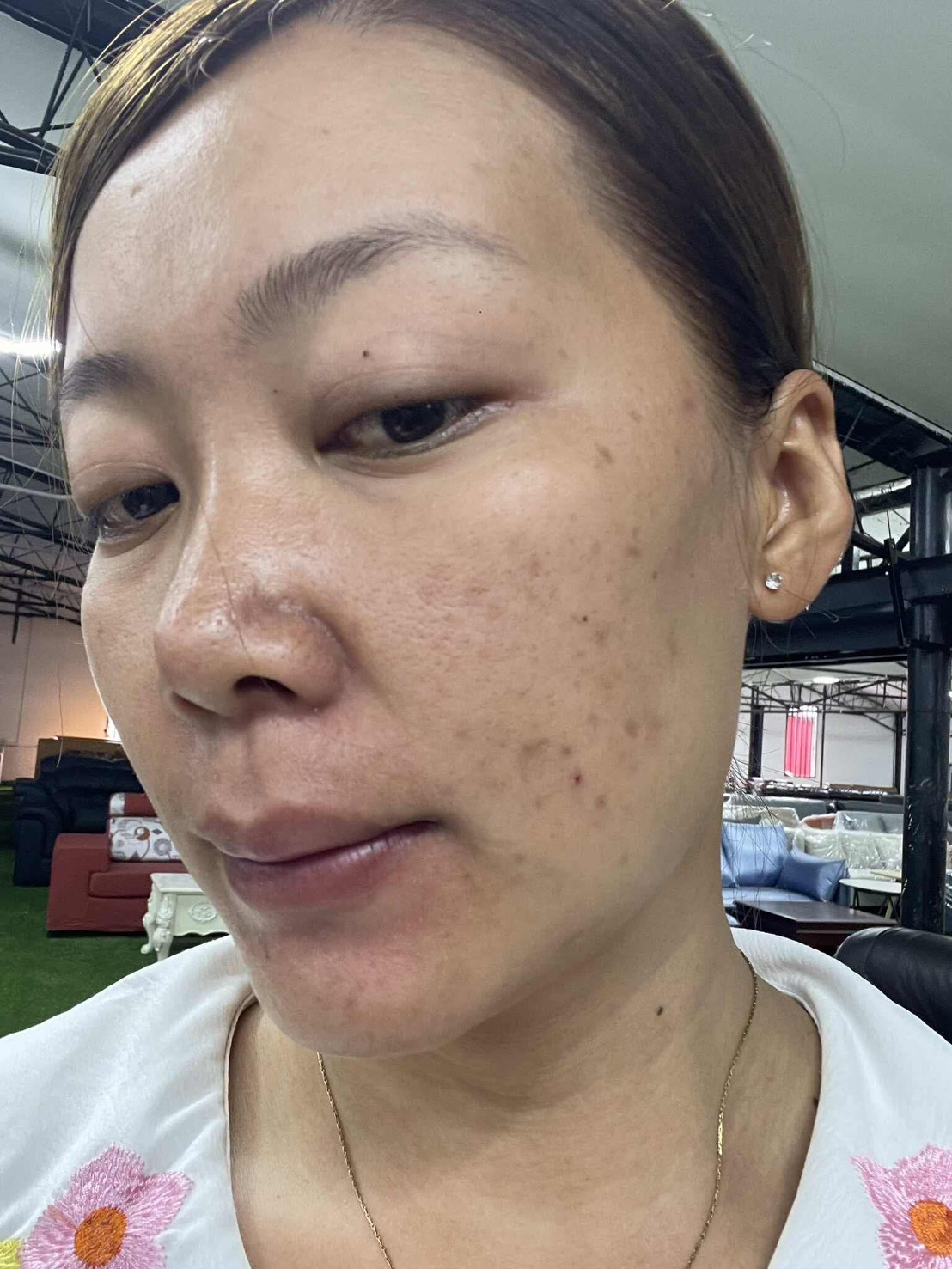 ก่อนใช้เซ็ต Elderé