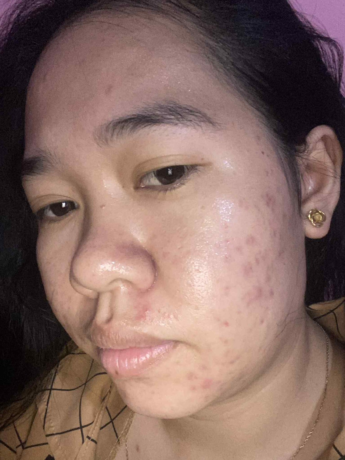 ก่อนใช้เซ็ต Elderé