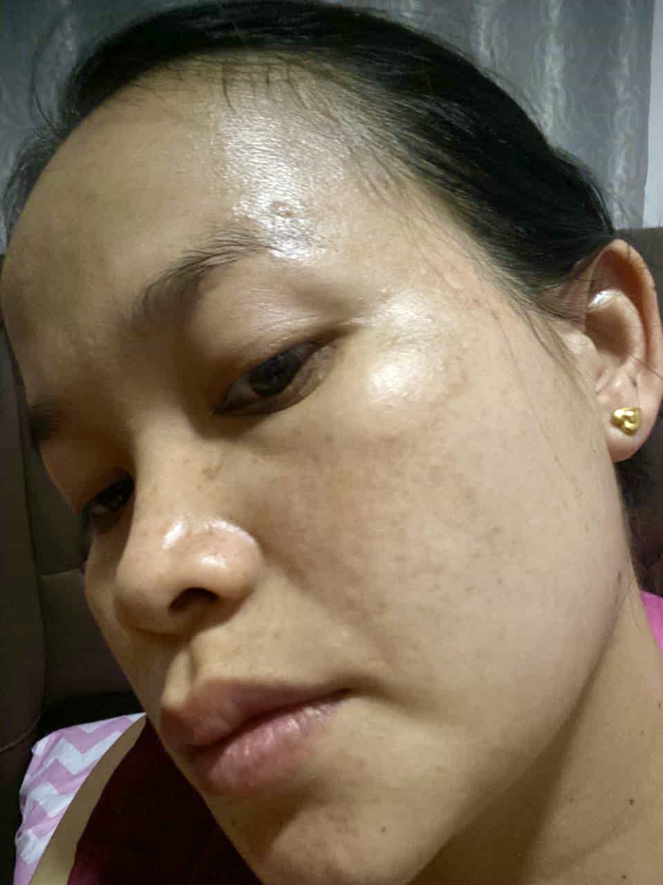 ก่อนใช้เซ็ต Elderé